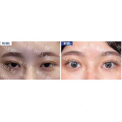 Will Be Plastic Surgery 案例