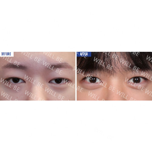 Will Be Plastic Surgery 案例