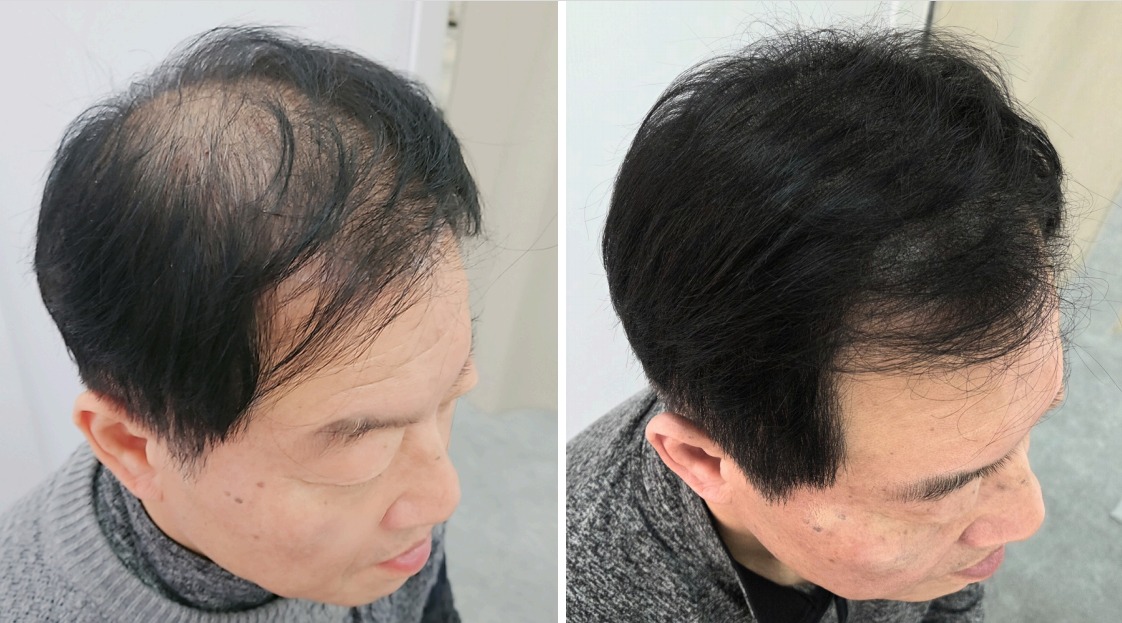 dottism半永久 案例