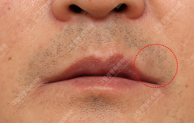 Geurim Plastic Surgery 案例