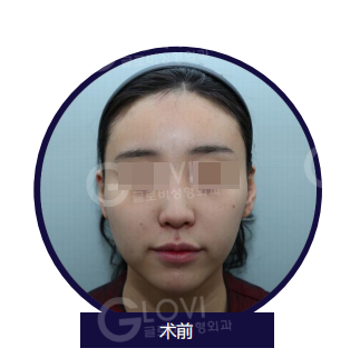 歌柔飛整形外科醫院 案例