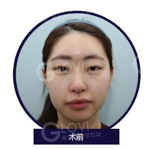 歌柔飛整形外科醫院 案例