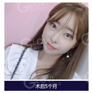 歌柔飛整形外科醫院 案例