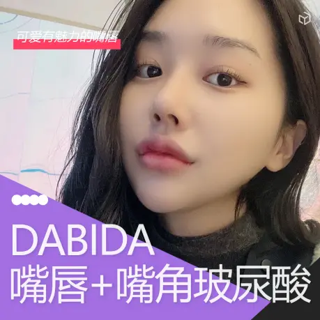 嘴巴玻尿酸