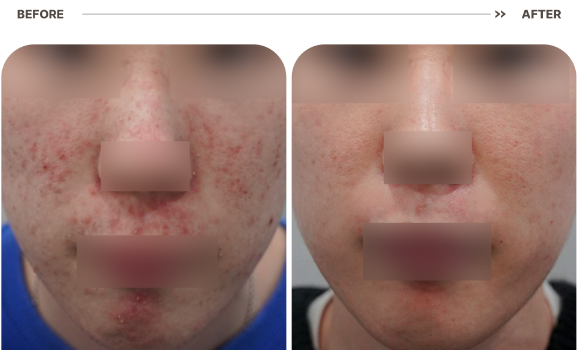 floria clinic 案例