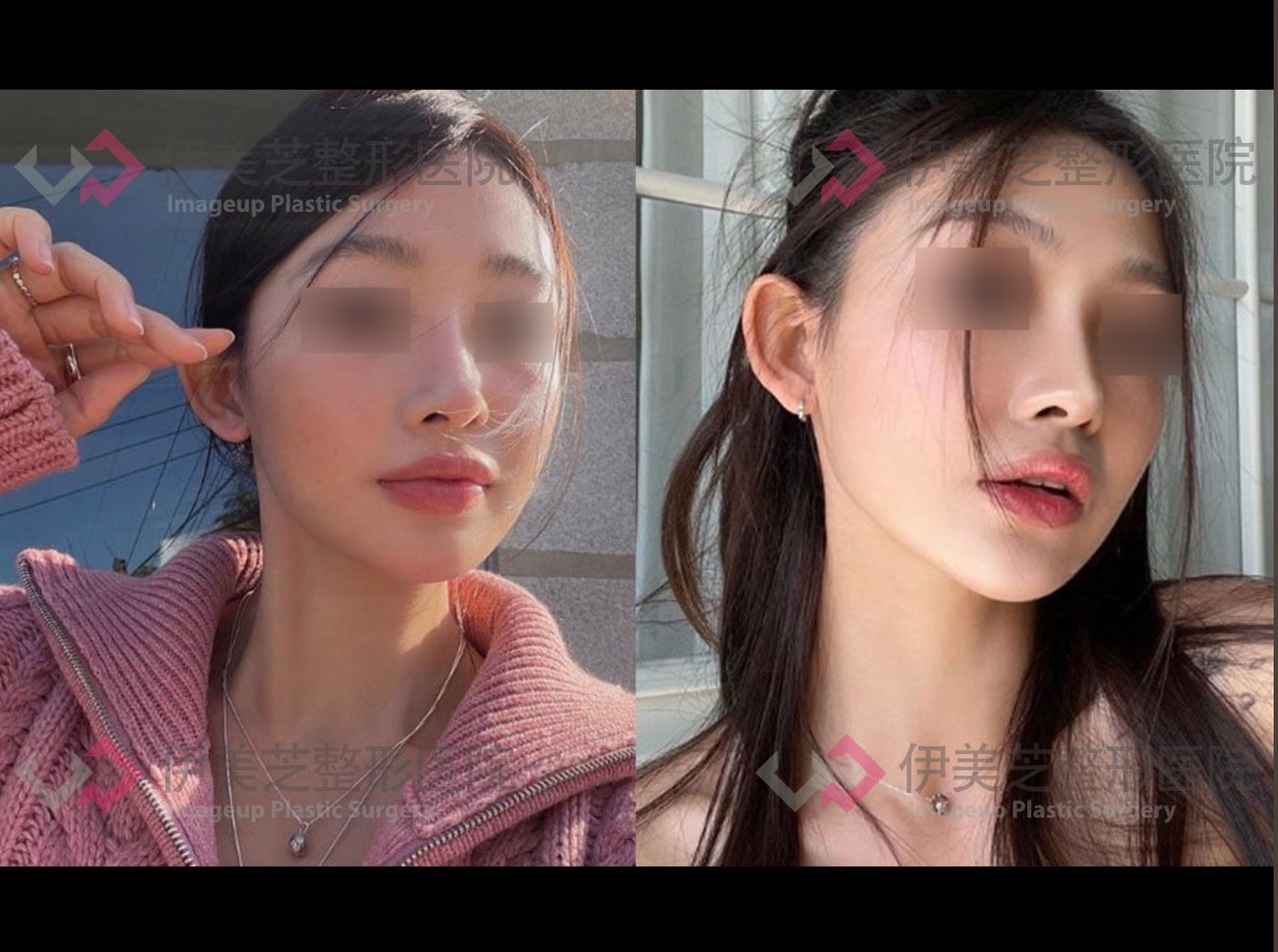 伊美芝皮膚科 案例