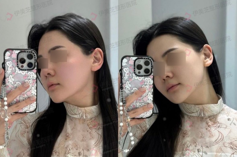 伊美芝皮膚科 案例