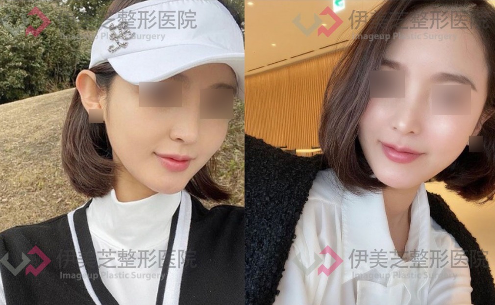 伊美芝皮膚科 案例