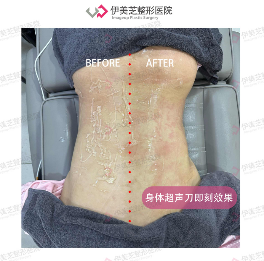 伊美芝皮膚科 案例