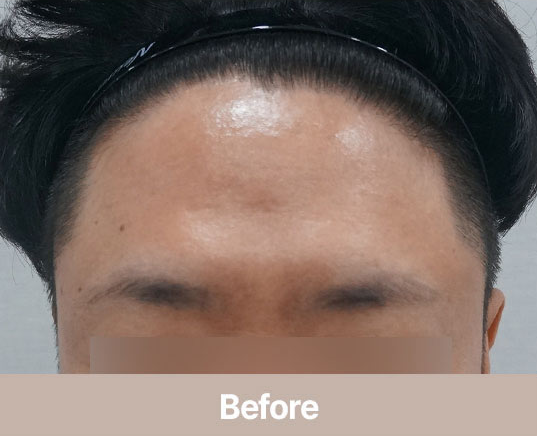 floria clinic 案例