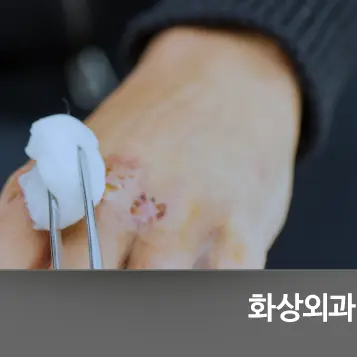 Burn and scald reconstruction and plastic surgery