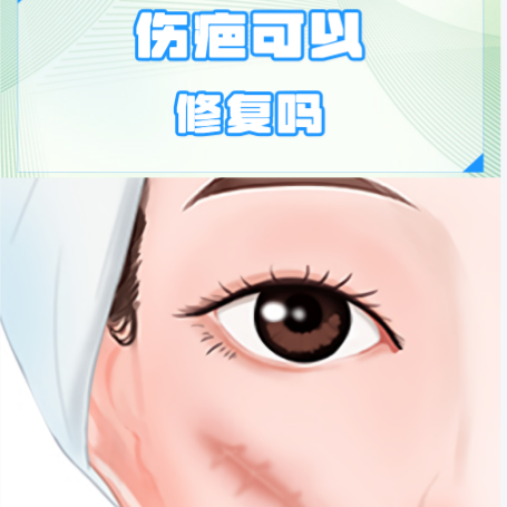 疤痕激光修复
