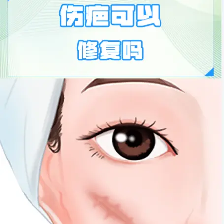 疤痕激光修复