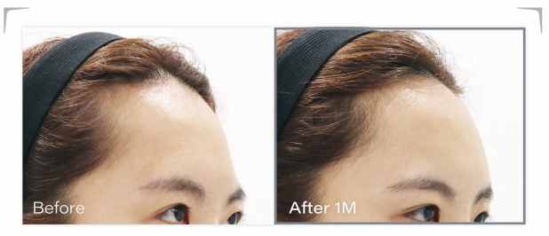 theia clinic 案例