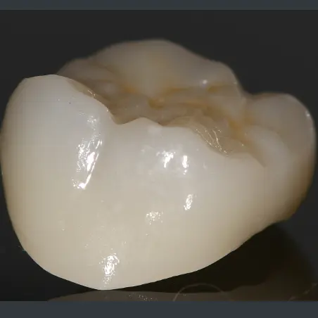 牙齿美白