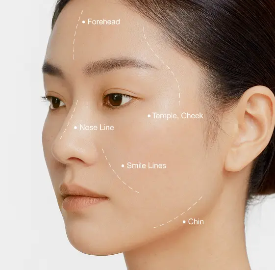 contour needle