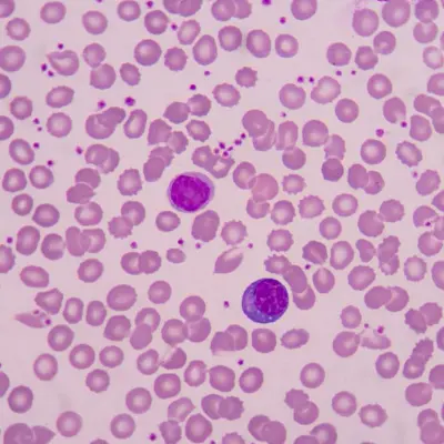 blood cells