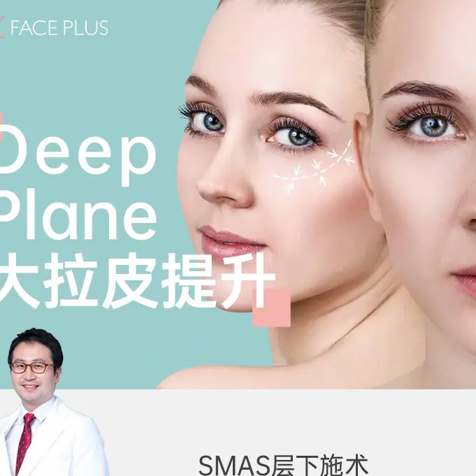 Minimally invasive facelift