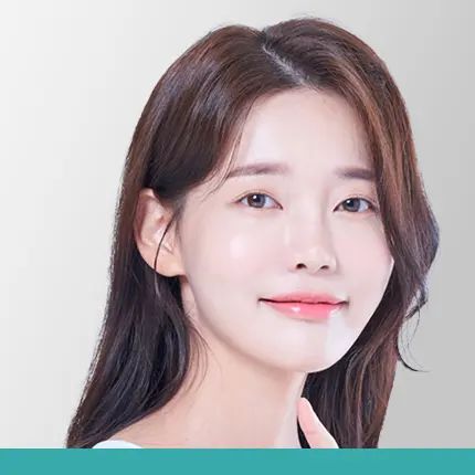 Corrective rhinoplasty for deviated nose