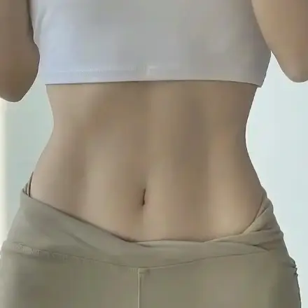 脐部整形