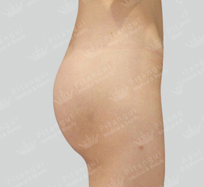 Pitangui Plastic Surgery 案例