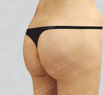 Pitangui Plastic Surgery 案例