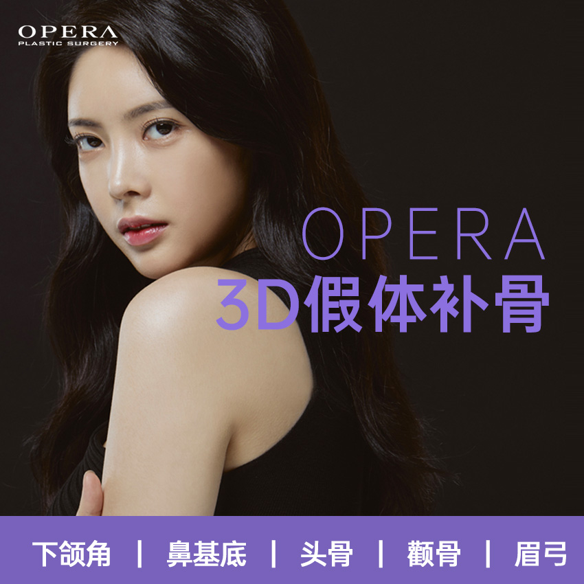 OPERA 3D Prosthetic Bone Augmentation: Mandibular Angle, Nasal Base, Skull, Zygoma, Brow Ridge