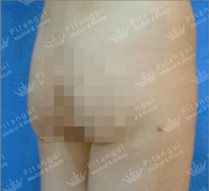 Pitangui Plastic Surgery 案例