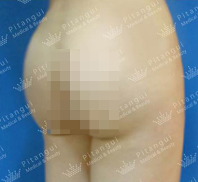Pitangui Plastic Surgery 案例