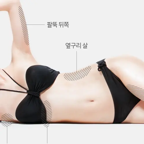 Body Lipolysis Injection