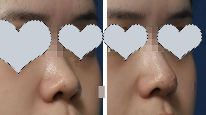 Kate premium derma clinic 案例