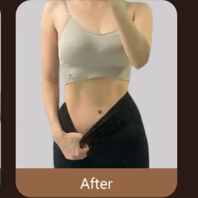 Waist and Abdomen Contouring