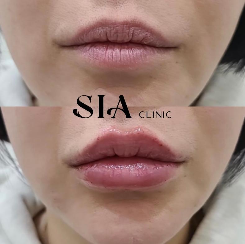 Sia clinic 案例