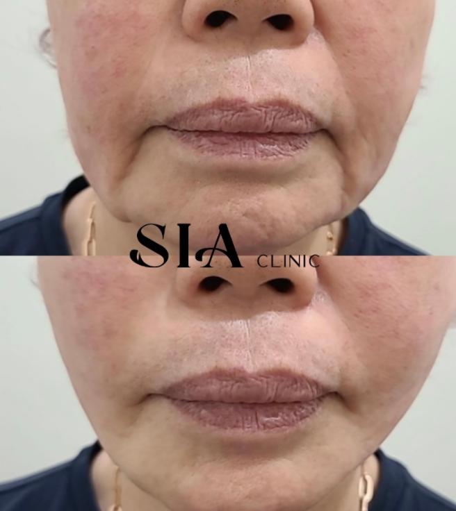 Sia clinic 案例
