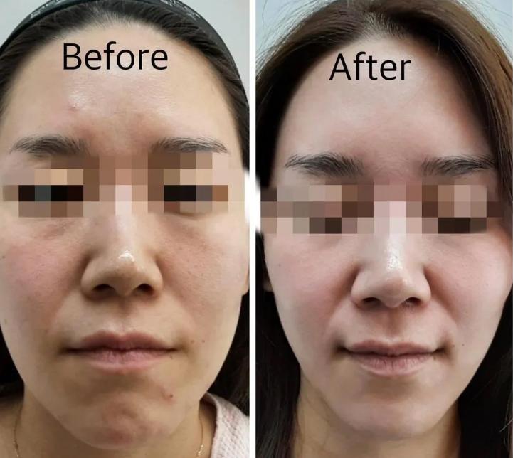 BELLE AMIE RENOVO CLINIC 案例