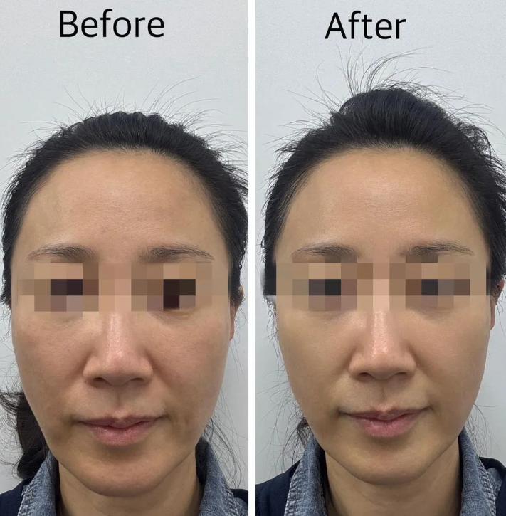 BELLE AMIE RENOVO CLINIC 案例