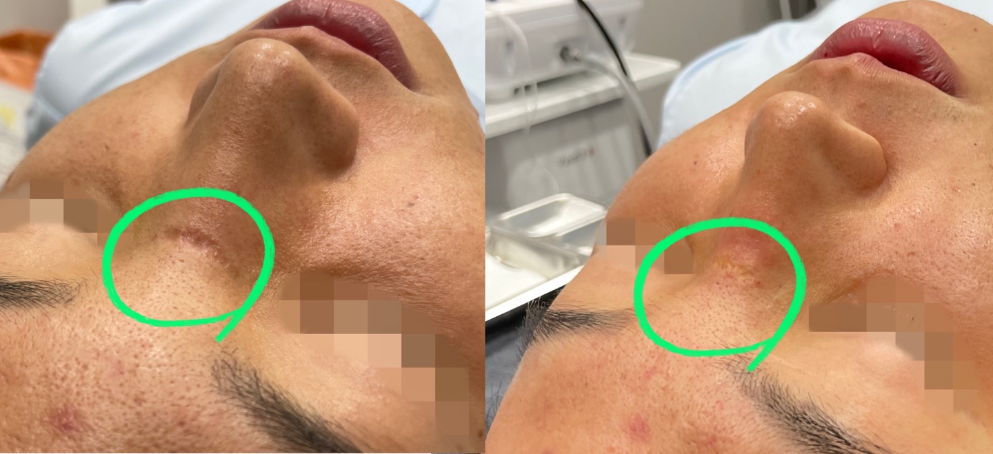 shinederma clinic 案例