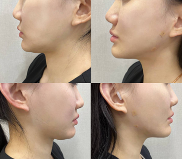 shinederma clinic 案例