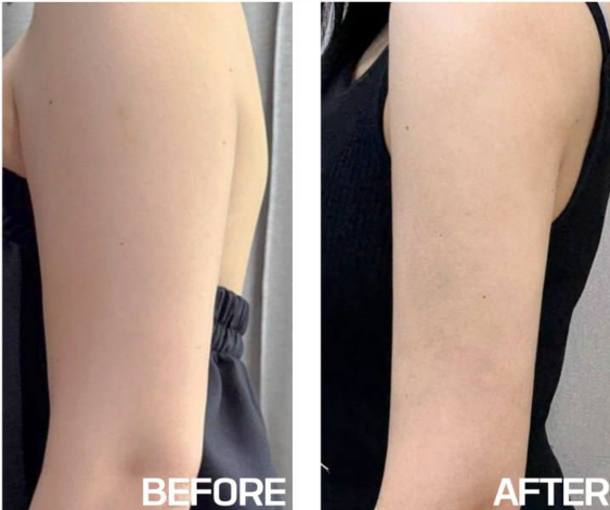 shinederma clinic 案例