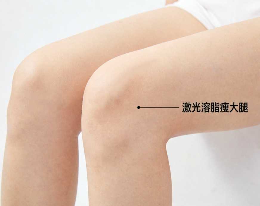 激光溶脂瘦大腿
