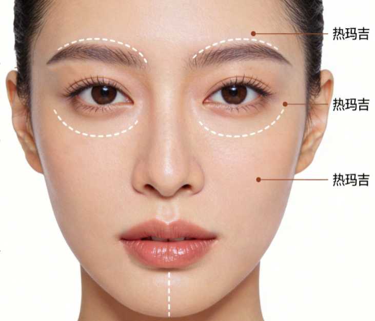 热玛吉.jpg