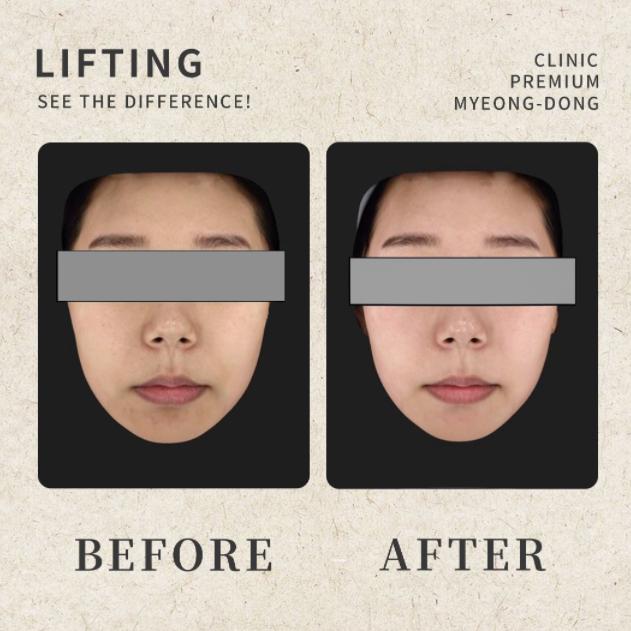 umi skin clinic 案例