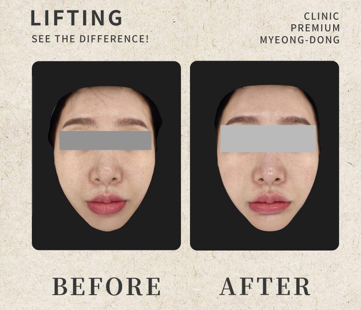umi skin clinic 案例