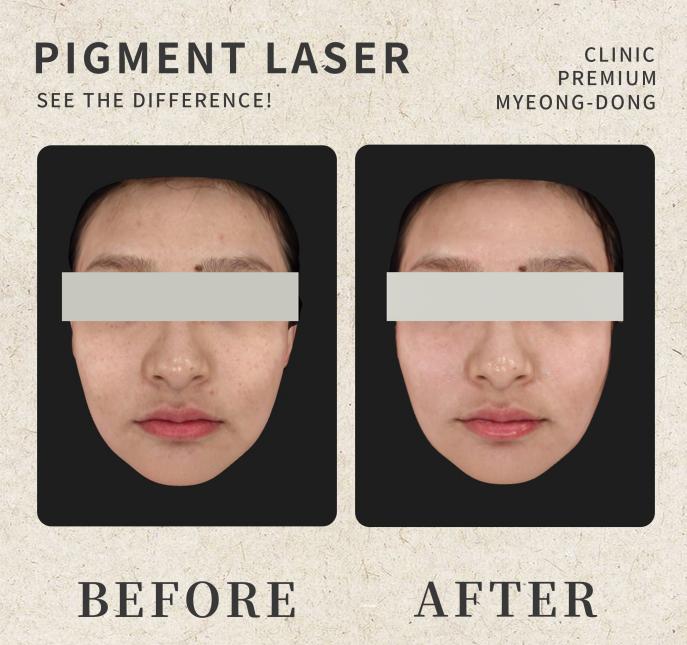 umi skin clinic 案例
