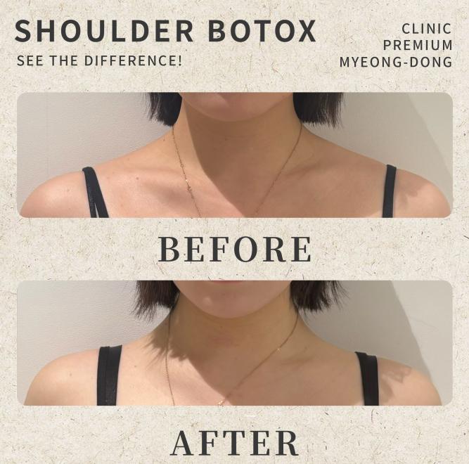 umi skin clinic 案例