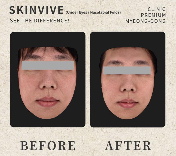 umi skin clinic 案例