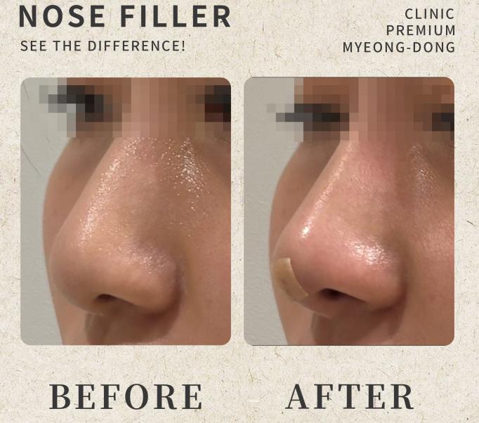 umi skin clinic 案例