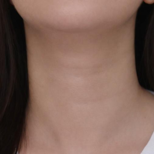 Allure Plastic Surgery 案例