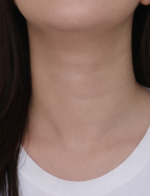 Allure Plastic Surgery 案例