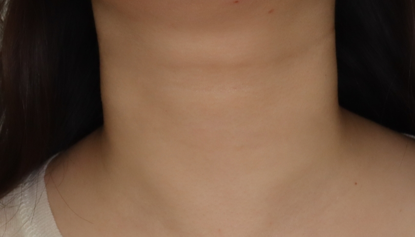 Allure Plastic Surgery 案例